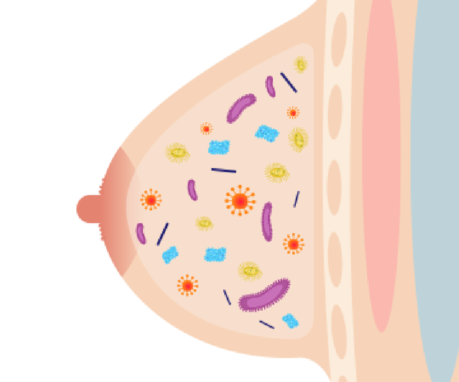 若出現乳腺炎症狀，記得多休息，並改變哺乳方式