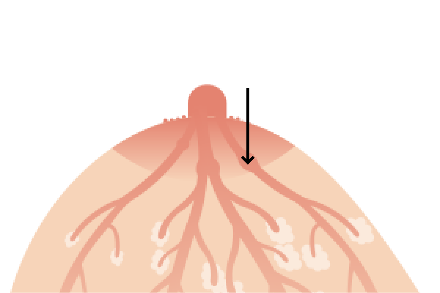 輸乳竇