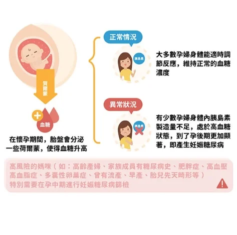 妊娠糖尿病原因-聽說孕中期開始容易出現妊娠糖尿病，到底什麼是妊娠糖尿病呢?